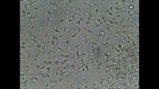 my sperm cells under a microscope [upl. by Ggerc626]