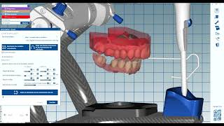 Exocad Exoplan 3Shape InLab Cerec millbox [upl. by Ailina552]