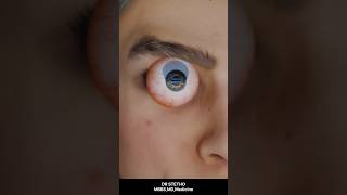 Contact lens side effect ytshorts trendingshorts trending health facts drstethombbsmdmedicine [upl. by Annora]