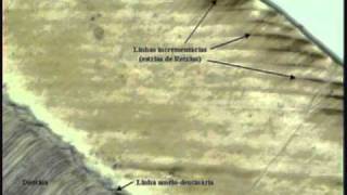 histologia del diente seccion Dwmv [upl. by Hamburger610]