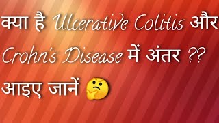 Ulcerative Colitis Versus Crohns Disease in Hindi Language [upl. by Vial]