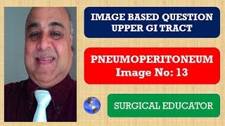 PNEUMOPERITONEUM Upper GI Tract Image Bsed Question [upl. by Balfour]