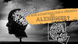 O que acontece com seu cérebro durante a Doença de Alzheimer [upl. by Adniral662]