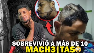 ESTA VIVO 😨 Lo robaron 😨 y no quedando contentos le propinaron más de 10 MACHETAS0S 😱 [upl. by Anirec]