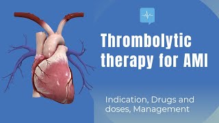 Thrombolytic therapy Indication treatment drugs and management [upl. by Conley]