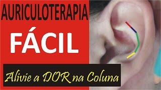 Auriculoterapia Nas Algias Vertebrais Aprenda Grátis Auriculoterapia [upl. by Tarr]