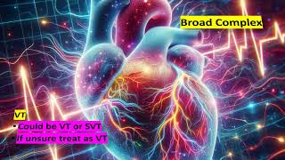 BROAD COMPLEX TACHYCARDIA IN PEDIATRICS [upl. by Micah]