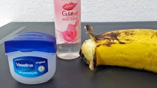 Remove Skin Pigmentation Using VASELINE ROSE WATER amp BANANAS  Simple Skin Care Beauty Hacks amp Tips [upl. by Nivrehs]