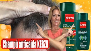 Tratamiento para la Caída del Cabello Graso  Cómo Frenar la Caída del Cabello  Champú menta KERZO [upl. by Adahs]