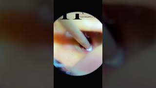 Ear Wax ASMR [upl. by Isman]