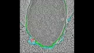 Identification and Characterization of Anaplasma phagocytophilum Proteins Involved in Infection [upl. by Jeffrey590]