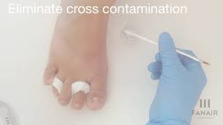 PediSafe Extreme Toenail Reconstruction [upl. by Yt]