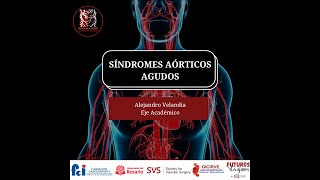 Síndromes Aórticos Agudos [upl. by Ettenhoj466]