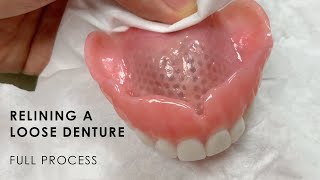 Relining a Loose Denture  Full Process [upl. by Toms]