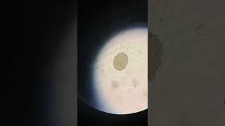 Ascaris lumbricoides fertilized eggmedicoaanchal03 neet mbbs microbiology shorts biology [upl. by Ater]