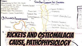 Rickets And Osteomalacia umerfarooqbiology7083 [upl. by Nicol]