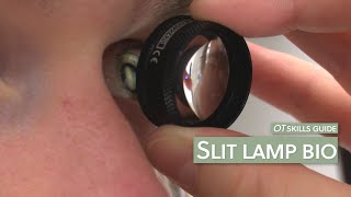 OT skills guide Slit lamp bio [upl. by Yenor]