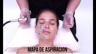 LIMPIEZA FACIAL CON MAQUINA [upl. by Manny]