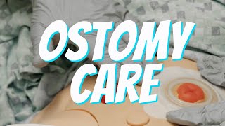 Colostomy and Ileostomy Care and Bag Change  Nurse Skill Demo [upl. by Beryl]