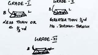 FurcationPart2 classification [upl. by Ehcnalb959]