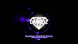 Vicetone feat Collin McLoughlin  Heartbeat DMNDZ Remix [upl. by Amand]