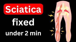 2 Top Sciatica Exercises In Under 2 Minutes NO MORE PAIN [upl. by Bijan350]