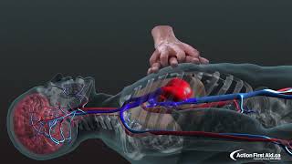 La RCP Réanimation CardioPulmonaire animation 3D [upl. by Isac]