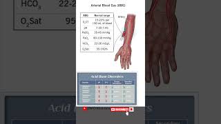 ABG analysis  ABG Report  Acid Base Disorders abg abgreport abganalysis arterialbloodgas [upl. by Jacobina]