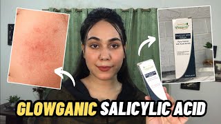 Glowganic Salicylic Acid Serum review  Shamaim Rajpoot [upl. by Robison788]