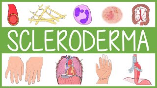 Scleroderma [upl. by Lac60]