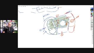 mRNA Vaccine in Human Milk  More Thoughts [upl. by Ettevram259]