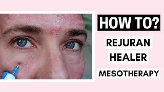 Rejuran Healer Skin Booster Mesotherapy Before And After Ft Vanidiy [upl. by Filberto85]