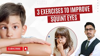 How To Fix Squint Eyes  Squint Eyes Meaning  Squint Eyes Treatment [upl. by Adai]