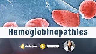 Hemoglobinopathies  Pathology Video Lectures  Medical Student Education  VLearning [upl. by Ardnik]