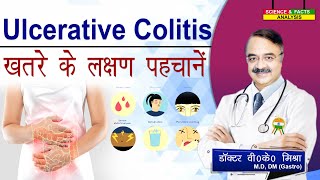 ULCERATIVE COLITIS ख़तरे के लक्षण पहचानें  ASK THE EXPERT HOW SERIOUS IS ULCERATIVE COLITIS [upl. by Eniarol349]