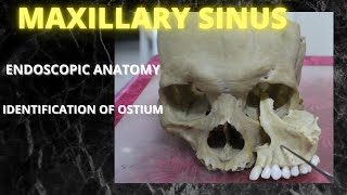 045 Anatomy Maxillary Sinus anatomylectures [upl. by Enihpets]