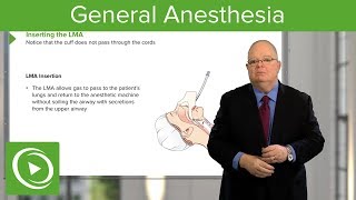 General Anesthesia – Anesthesiology  Lecturio [upl. by Mayhew]