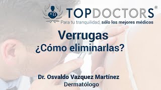 ¿Cómo eliminar las verrugas  Tratamientos [upl. by Spurgeon]