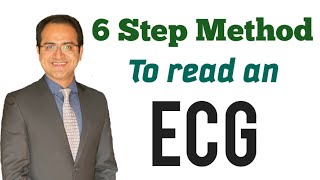 ECG Interpretation Made Easy By 6 Step Method How to read an EKG ECG Lectures USMLE NEET PG [upl. by Enobe]