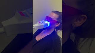 Zahnaufhellung Mit Liebe zum Detail Kosmetiksalon 🦷 skincare shortsvideo teethbleaching [upl. by Tartan]