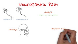 Neuropathic pain [upl. by Zebedee]