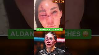 AFTER UFC 306 FIGHT IRENE ALDANA 😭😭 [upl. by Eleanor]