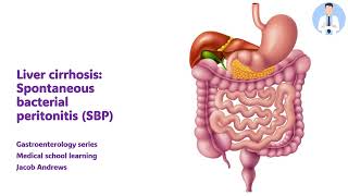 SPONTANEOUS BACTERIAL PERITONITIS [upl. by Clementi]