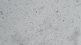 Human sperm under a microscope X40 [upl. by Shiverick108]