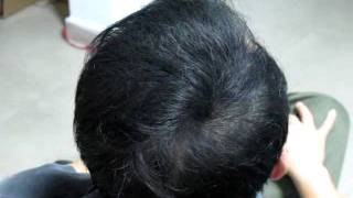 How to Thicken Hair Naturally [upl. by Llenyar821]