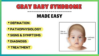 Gray baby syndrome causes symptoms treatment pharmacology made easy [upl. by Opalina390]