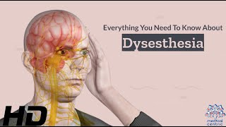 Dysesthesia 101 A Comprehensive Guide to this Mysterious Condition [upl. by Santiago]