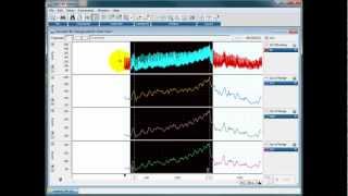 blood pressure mean sys and diastolic [upl. by Sarena979]