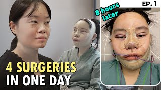 SUB quotI GOT A FULL FACE PLASTIC SURGERY IN KOREAquot VLOG  FACIAL CONTOURING RHINOPLASTY amp RECOVERY [upl. by Lekzehcey]