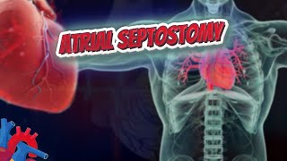 Atrial septostomy Human Heart ❤️ amp Cardiology ❤️🔊✅ [upl. by Rayburn]